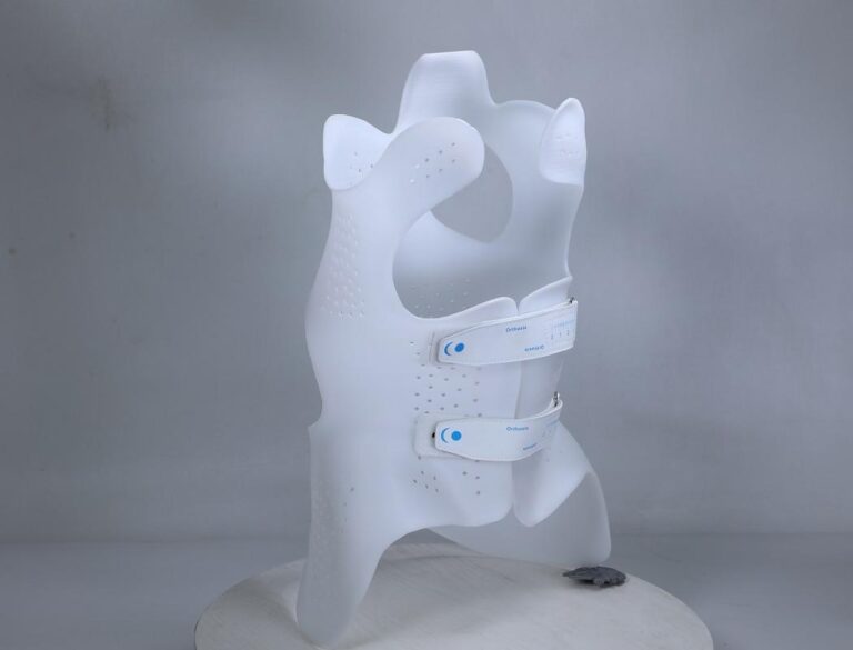 3d printed scoliosis brace