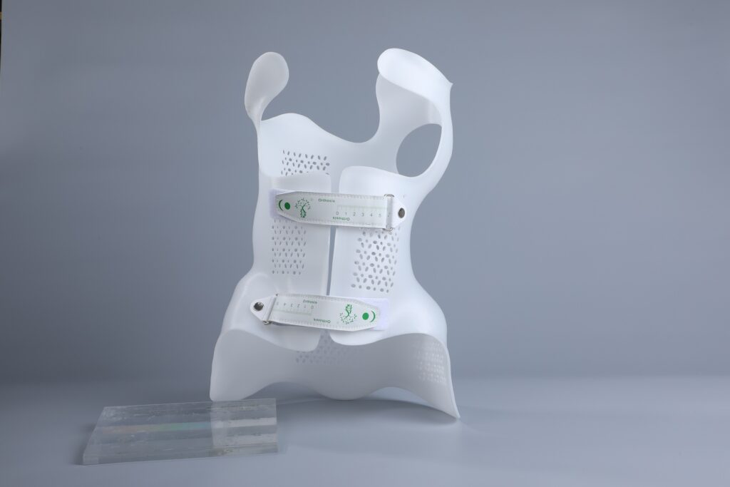 3d printing scoliosis