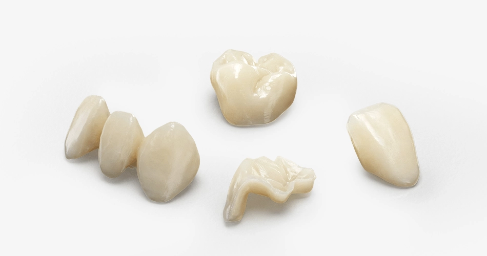 Veneers & Crowns & Inlays