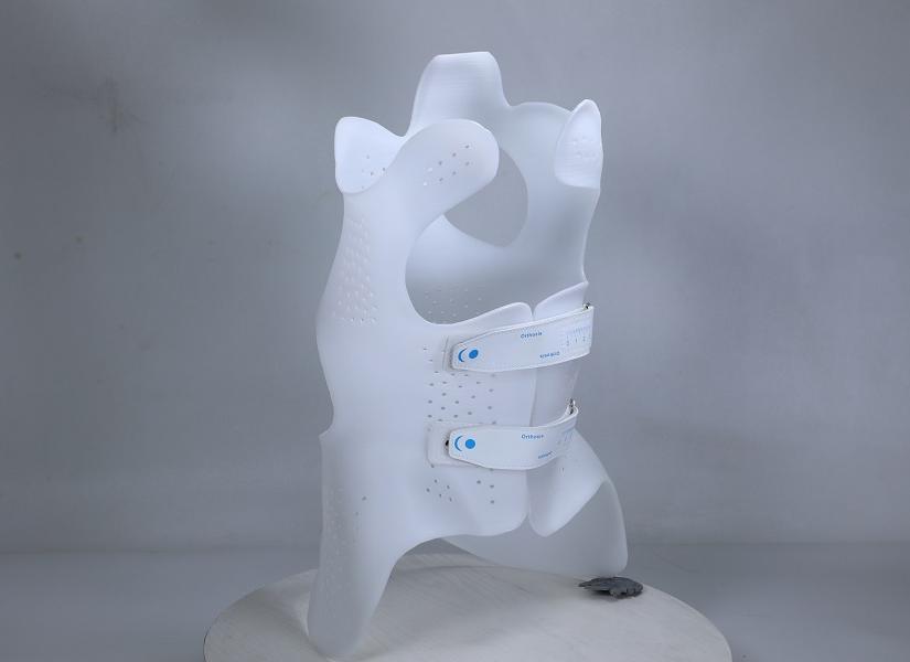 3D printing Scoliosis solutions