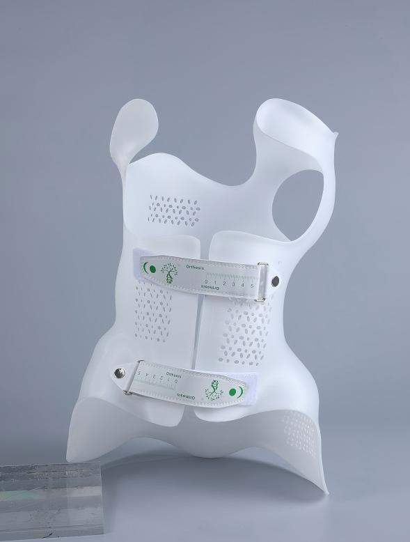 3d printed scoliosis brace (2)