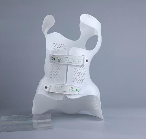 3d printing scoliosis(1)