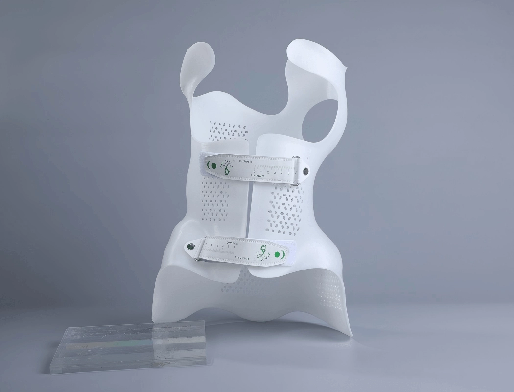 Rethinking Scoliosis Orthosis How 3D Printing Transforms Comfort, Precision, and Efficiency