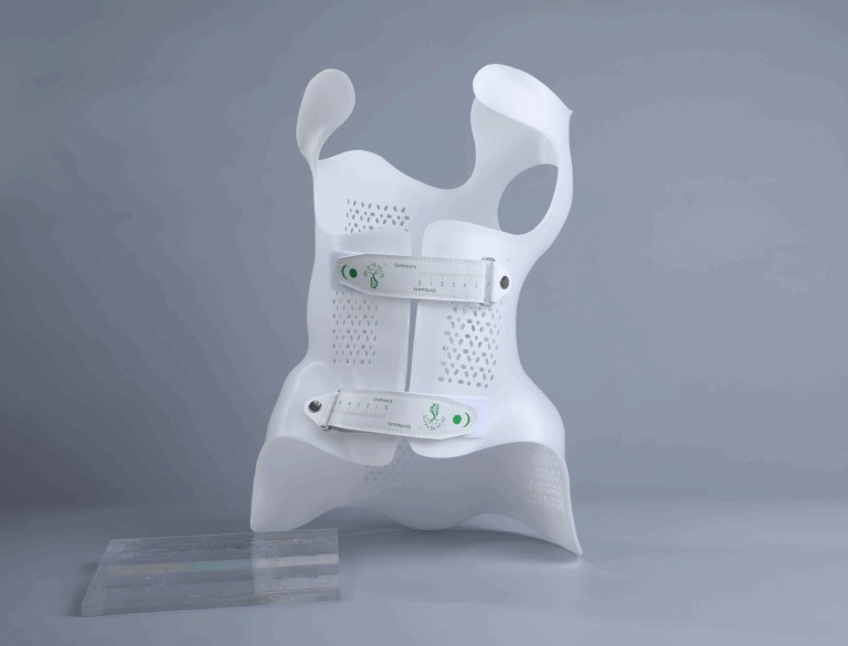 Rethinking Scoliosis Orthosis How 3D Printing Transforms Comfort, Precision, and Efficiency