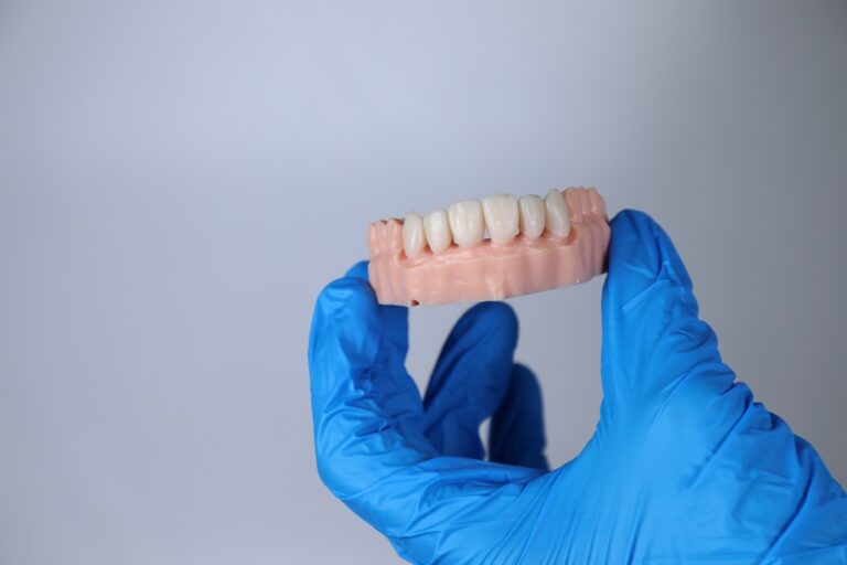 3d printing dental crowns