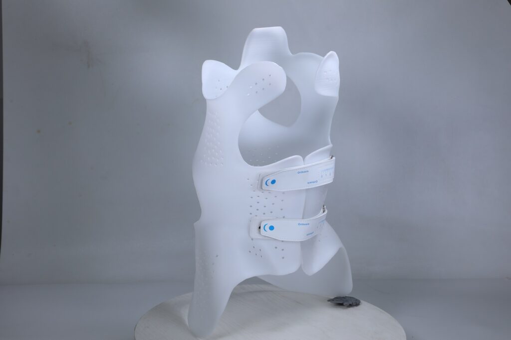 3D printing Scoliosis solutions