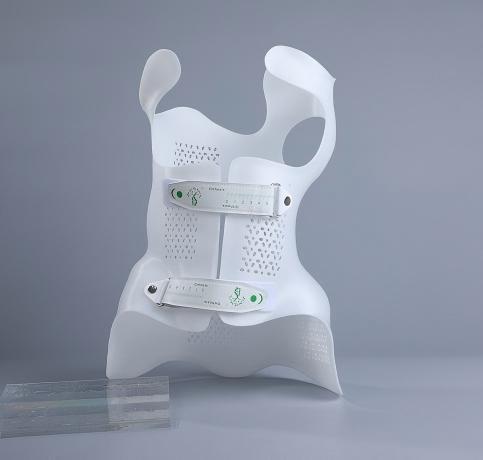3d printing scoliosis(1)