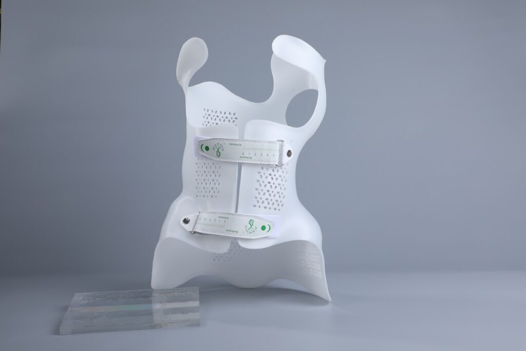 3d printing scoliosis orthoses