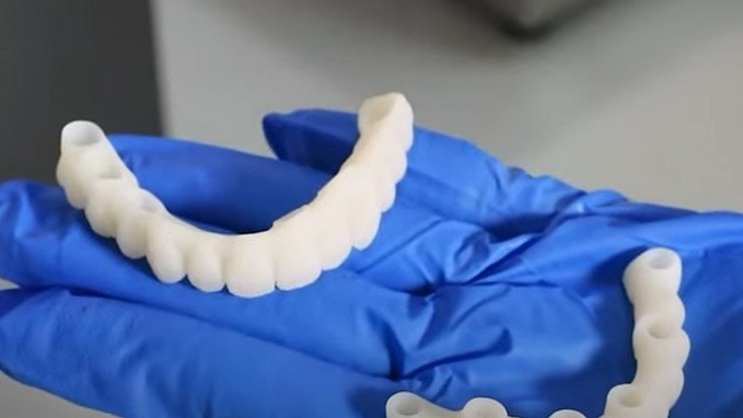 D158 - Surgical Guide