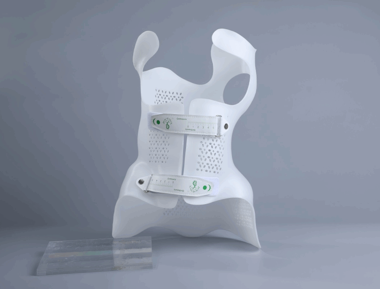 Rethinking Scoliosis Orthosis How 3D Printing Transforms Comfort, Precision, and Efficiency