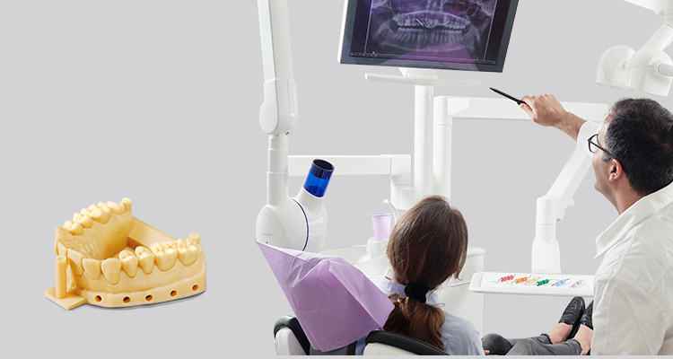 After purchasing dental 3D printer, what maintenance needs to be done later?