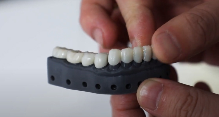 Can dental 3D printer print teeth?