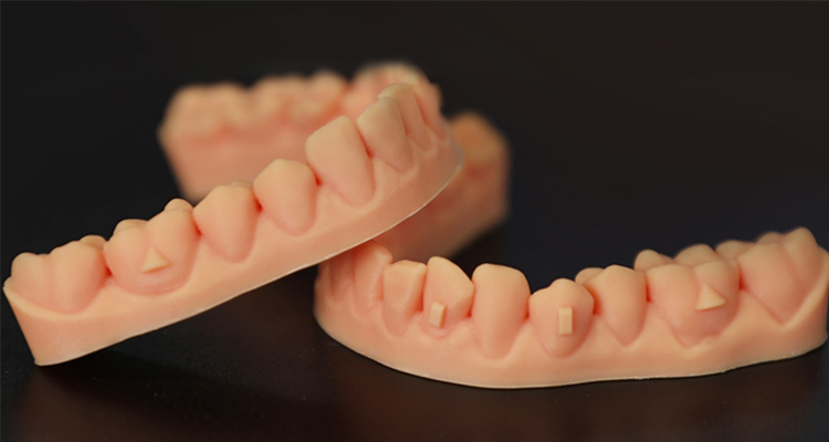 The most eye-catching: the application of 3D printing technology in the dental field