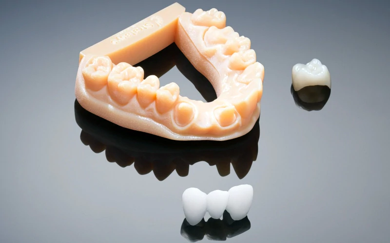  What is dental 3D printing used for?