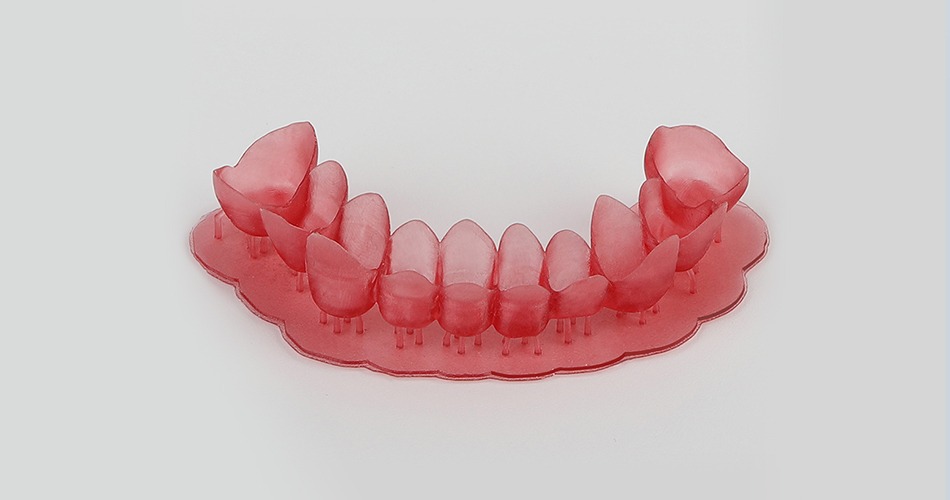 Dental casting
