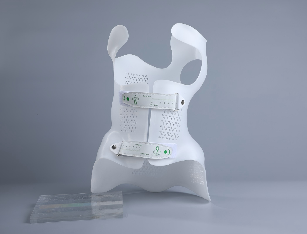 Rethinking Scoliosis Orthosis How 3D Printing Transforms Comfort, Precision, and Efficiency